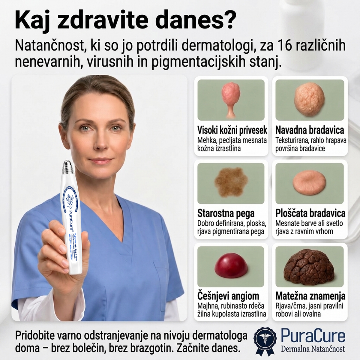 ✨ PuraCure® Rezultati so vidni že v 7 dneh! Valjček za odstranjevanje bradavic in drugih kožnih težav | Neboleče in minimalno razmaže.