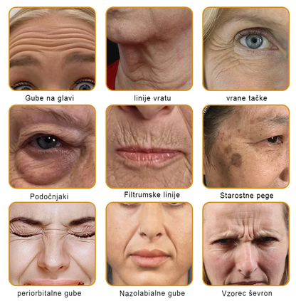 Sinvie® Krema za obnovo kože z čebeljim strupom | 50 ml | Priporočeno češko dermatovenerološko društvo