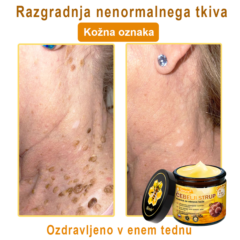 Sinvie® Krema za obnovo kože z čebeljim strupom | 50 ml | Priporočeno češko dermatovenerološko društvo