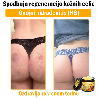 🔥 PuraCure® Krema za obnovo kože z čebeljim strupom | 50 ml | Priporočeno češko dermatovenerološko društvo