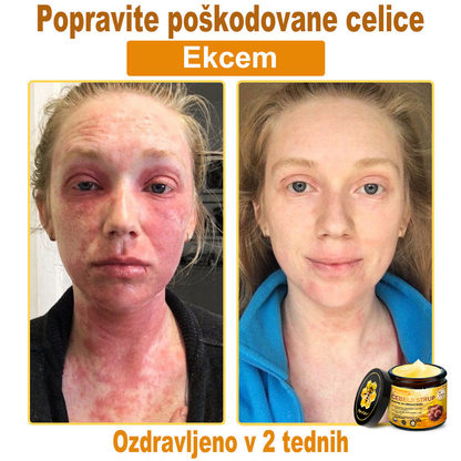 🔥 PuraCure® Krema za obnovo kože z čebeljim strupom | 50 ml | Priporočeno češko dermatovenerološko društvo