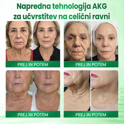 💝 Medistart® AKG – Učvrstitvena nega kože proti znakom staranja 💝