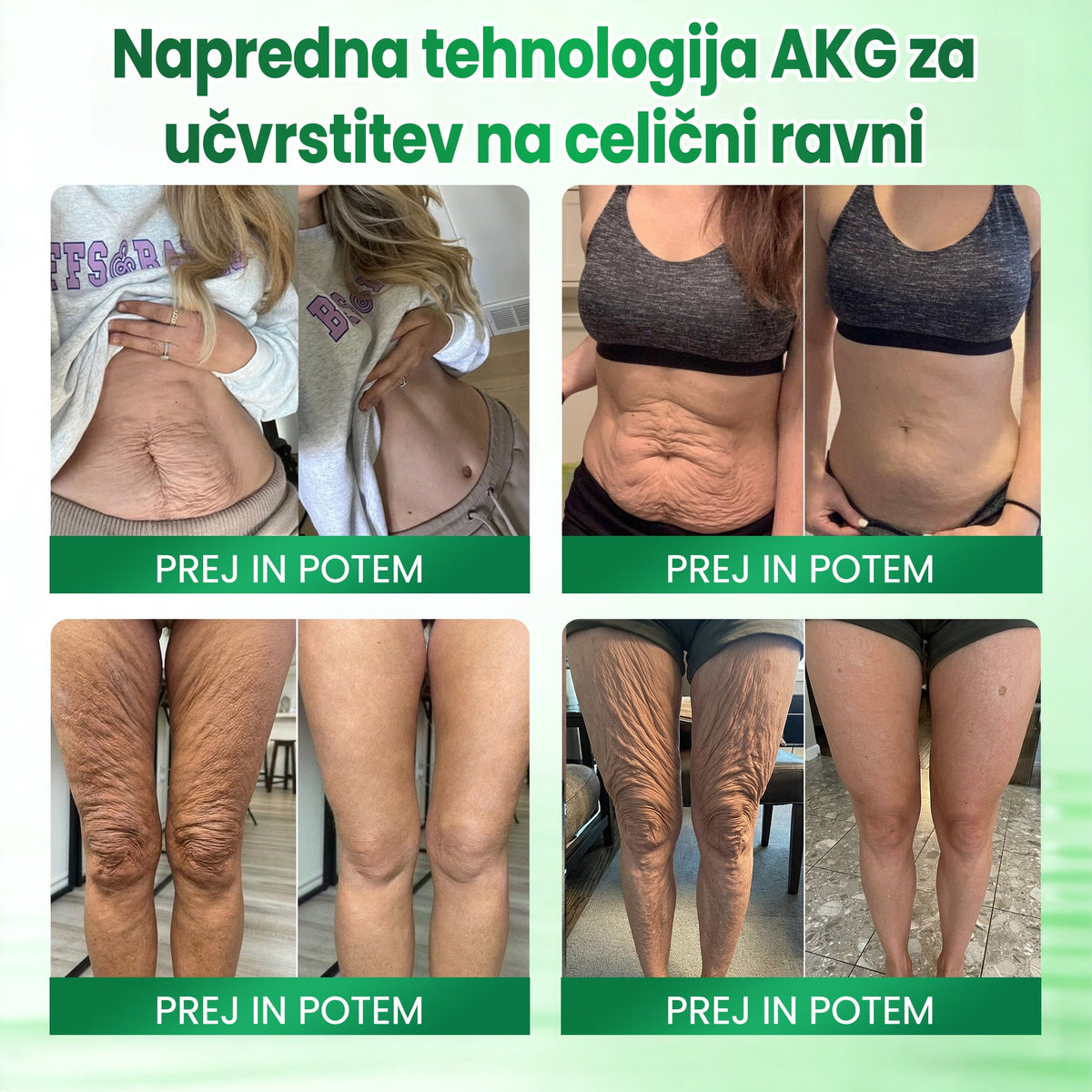 💝 Medistart® AKG – Učvrstitvena nega kože proti znakom staranja 💝