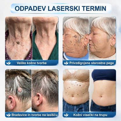 ✨ PuraCure® Rezultati so vidni že v 7 dneh! Valjček za odstranjevanje bradavic in drugih kožnih težav | Neboleče in minimalno razmaže.