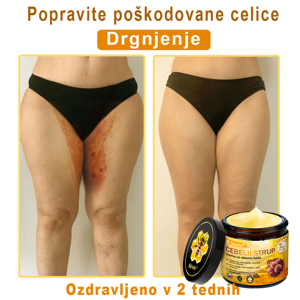 Sinvie® Krema za obnovo kože z čebeljim strupom | 50 ml | Priporočeno češko dermatovenerološko društvo