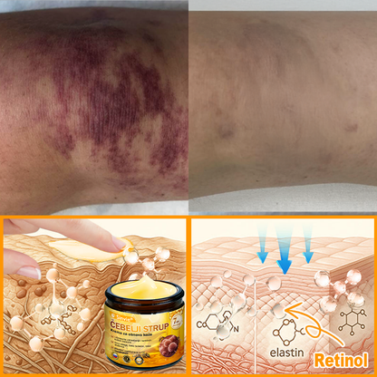 Sinvie® Krema za obnovo kože z čebeljim strupom | 50 ml | Priporočeno češko dermatovenerološko društvo