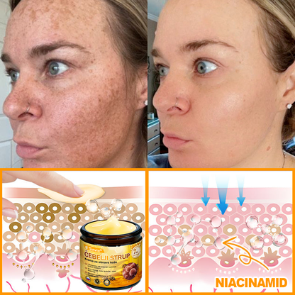 Sinvie® Krema za obnovo kože z čebeljim strupom | 50 ml | Priporočeno češko dermatovenerološko društvo
