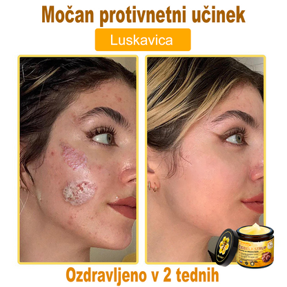 🔥 PuraCure® Krema za obnovo kože z čebeljim strupom | 50 ml | Priporočeno češko dermatovenerološko društvo