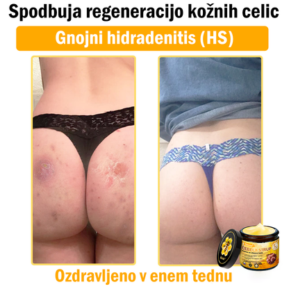 Sinvie® Krema za obnovo kože z čebeljim strupom | 50 ml | Priporočeno češko dermatovenerološko društvo